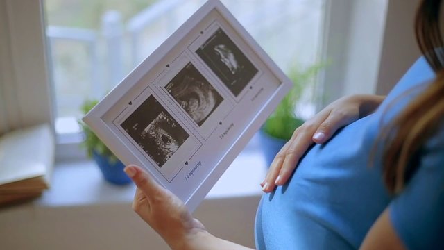 Mehr über den Artikel erfahren Schwangerschaftsdiabetes – kein persönliches Versagen